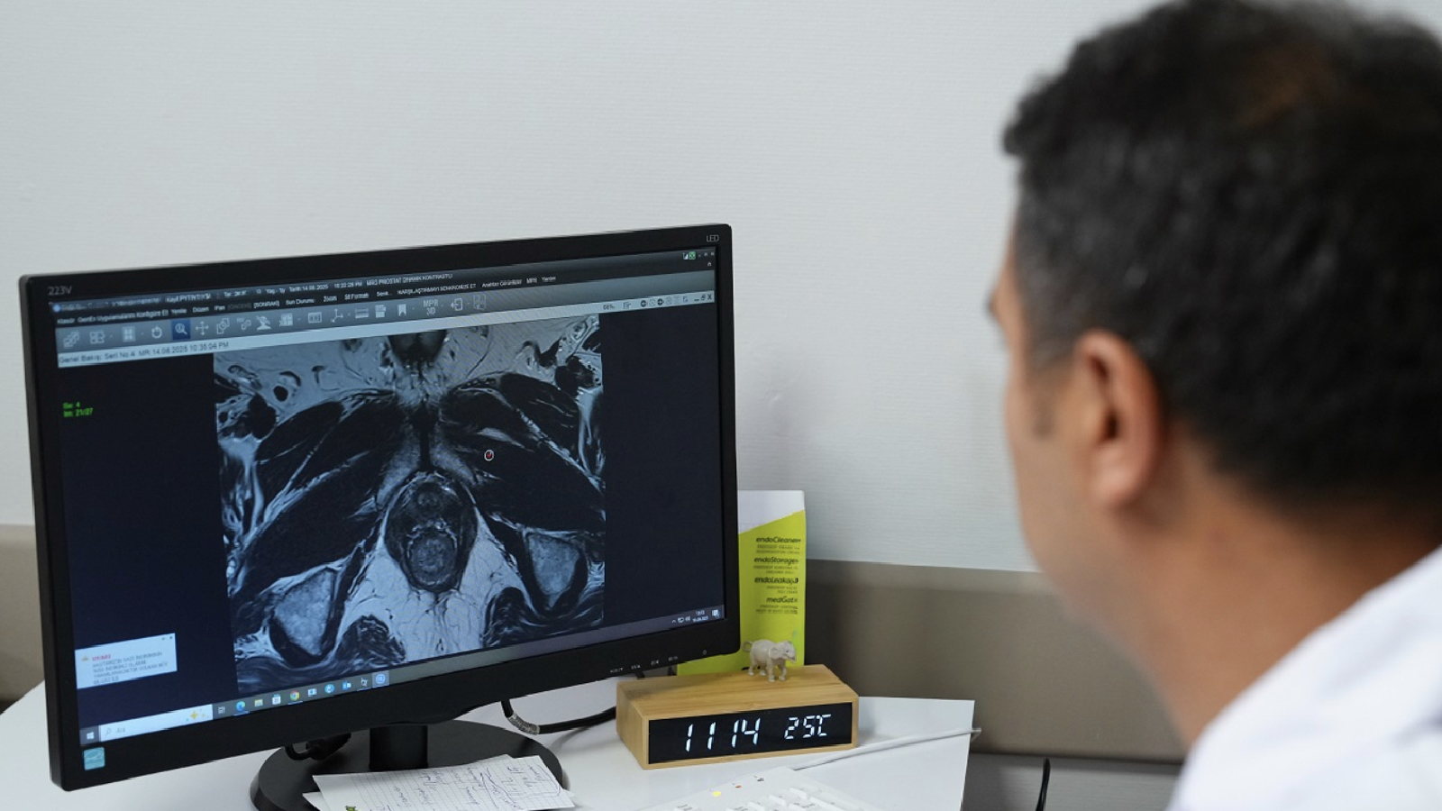 uzmanindan prostat kanserinde dogru tani uyarisi fuzyon biyopsi ile tumor odaklari hedefe yonelik sekilde tespit edilebiliyor quplaa6l